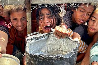 Moaz Abu Taha/APA Images via ZUMA Press Wire/dpa | Unicef warnt vor den fatalen Folgen der zunehmenden Mangelernährung von Kindern im Gazastreifen. Die Jüngsten gerieten durch Hunger und Krankheiten in einen Teufelskreis.